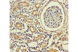 Immunohistochemistry of paraffin-embedded human kidney tissue using ABIN7157448 at dilution of 1:100 (Keratin 71 antibody  (AA 201-500))