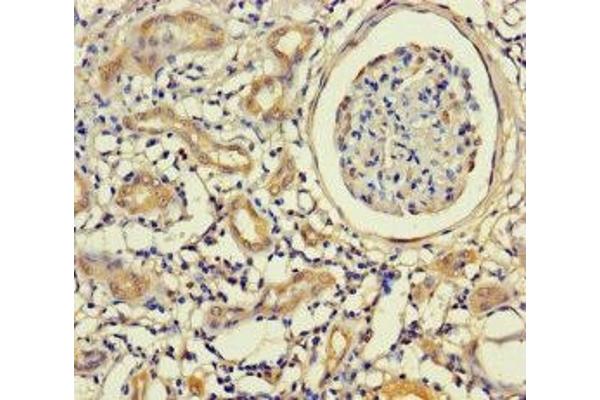 Keratin 71 antibody  (AA 201-500)