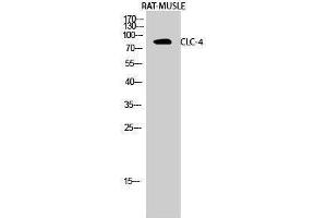 Western Blotting (WB) image for anti-Chloride Channel 4 (CLCN4) (Internal Region) antibody (ABIN3183949) (CLCN4 antibody  (Internal Region))