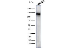 Western Blotting (WB) image for anti-CD68 Molecule (CD68) antibody (ABIN6941238)