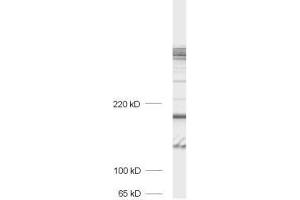 dilution: 1 : 1000, sample: crude synaptosomal fraction of rat brain (P2) (Bassoon antibody)