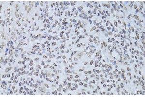 Immunohistochemistry (Paraffin-embedded Sections) (IHC (p)) image for anti-Lamin B2 (LMNB2) antibody (ABIN7262334)
