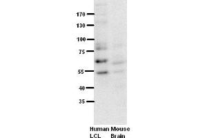 Western Blotting (WB) image for anti-Runt-Related Transcription Factor 1 (RUNX1) (Middle Region) antibody (ABIN2792598)