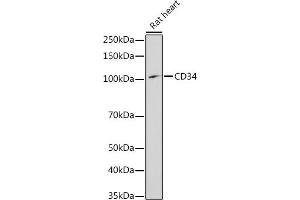 Western blot analysis of extracts of Rat heart, using CD34 antibody (ABIN3021123, ABIN3021124, ABIN3021125, ABIN1512704 and ABIN6213981) at 1:1000 dilution. (CD34 antibody  (AA 32-290))