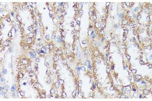Immunohistochemistry of paraffin-embedded Rat kidney using MTHFD2 Polyclonal Antibody at dilution of 1:100 (40x lens). (MTHFD2 antibody)