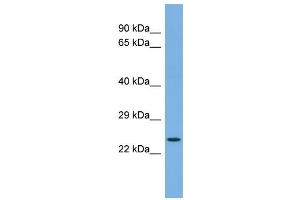 Host:  Rabbit  Target Name:  FAP  Sample Type:  COLO205 Whole cell lysates  Antibody Dilution:  1.
