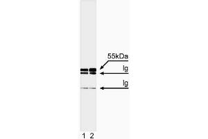 Immunoprecipitation/western blot analysis of caspase-8. (Caspase 8 antibody  (full length))
