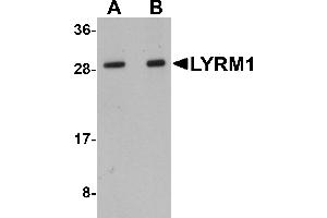 Western Blotting (WB) image for anti-LYR Motif Containing 1 (LYRM1) (Middle Region) antibody (ABIN1030991)