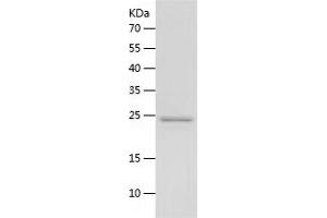 COL6A2 Protein (AA 820-1019) (His tag)