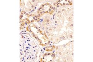 (ABIN391002 and ABIN2841178) staining PKC beta1/2 in human kidney tissue sections by Immunohistochemistry (IHC-P - paraformaldehyde-fixed, paraffin-embedded sections). (PKC beta1/2 (AA 303-334) antibody)