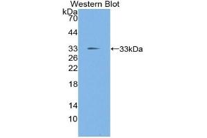 Detection of Recombinant TIEG1, Mouse using Polyclonal Antibody to TGF Beta Inducible Early Response Gene 1 (TIEG1) (KLF10/TIEG1 antibody  (AA 206-473))