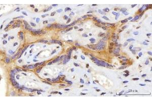 IHC analysis of CEP250 using anti-CEP250 antibody (ABIN7602053). (CEP250 antibody  (AA 563-853))