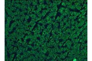 Immunohistochemistry on frozen sections of human liver hepatocytes (Keratin 5/8 antibody)