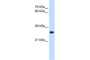 Western Blotting (WB) image for anti-T-Cell Acute Lymphocytic Leukemia 1 (TAL1) antibody (ABIN2463873) (TAL1 antibody)