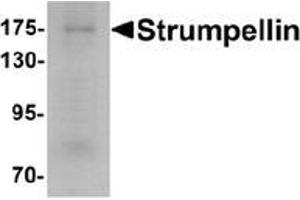 Western blot analysis of Strumpellin in human ovary tissue lysate with Strumpellin Antibody  at 1 μg/ml. (Strumpellin antibody  (C-Term))