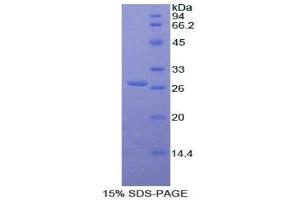 SDS-PAGE analysis of Human Catenin beta 1 Protein. (CTNNB1 Protein)