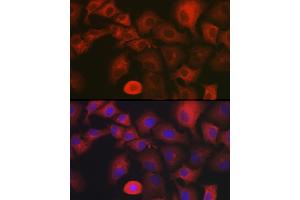 Immunofluorescence analysis of A-549 cells using MYO10 antibody (ABIN6128319, ABIN6144271, ABIN6144274 and ABIN6216113) at dilution of 1:350.