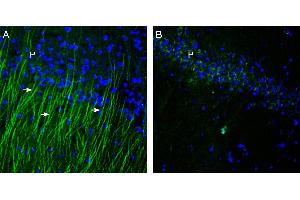 Expression of TRPM6 in rat hippocampus. (TRPM6 antibody  (1st Extracellular Loop))