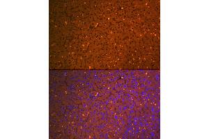 Immunofluorescence (IF) image for anti-alpha-2-Macroglobulin (A2M) antibody (ABIN7265558)