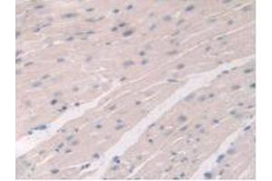 IHC-P analysis of Mouse Heart Tissue, with DAB staining. (DDX58 antibody  (AA 1-211))