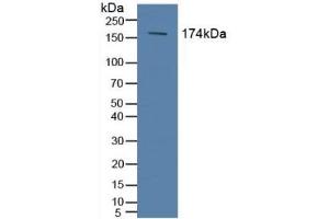 Detection of ABCC2 in Human Serum using Polyclonal Antibody to ATP Binding Cassette Transporter C2 (ABCC2) (ABCC2 antibody  (AA 1300-1534))