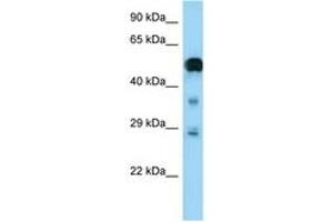 Image no. 1 for anti-Neurofibromin 2 (NF2) (AA 357-406) antibody (ABIN6748185) (Merlin antibody  (AA 357-406))