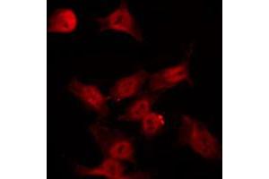 Immunofluorescence (fixed cells) (IF/ICC) image for anti-serum/glucocorticoid Regulated Kinase 1 (SGK1) (pSer422) antibody (ABIN6256329)