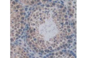 Figure. (RACGAP1 antibody  (AA 106-539))