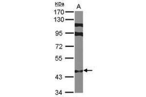 Image no. 1 for anti-Zinc Finger Protein 384 (ZNF384) (N-Term) antibody (ABIN1494117) (ZNF384 antibody  (N-Term))