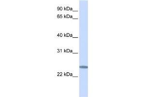 WB Suggested Anti-C12orf49 Antibody Titration:  0. (C12orf49 antibody  (C-Term))