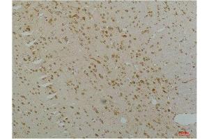 Immunohistochemistry (IHC) analysis of paraffin-embedded Rat Brain Tissue using Cav1. (CACNA1C antibody)