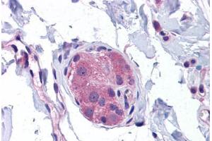 Human Small Intestine, Submucosal Plexus: Formalin-Fixed, Paraffin-Embedded (FFPE) (NOD1 antibody  (C-Term))
