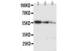 Lane 3: Recombinant Human Ki67 Protein 2. (Ki-67 antibody  (C-Term))