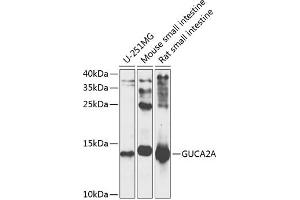 Western blot analysis of extracts of various cell lines, using GUCA antibody (ABIN6127993, ABIN6141529, ABIN6141530 and ABIN6225126) at 1:1000 dilution. (GUCA2A antibody  (AA 22-115))