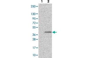 Western blot analysis of Lane 1: Negative control (vector only transfected HEK293T lysate). (MFSD5 antibody)