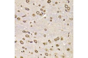 Immunohistochemistry (Paraffin-embedded Sections) (IHC (p)) image for anti-Lamin B2 (LMNB2) (AA 341-620) antibody (ABIN6143268)