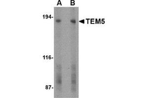 Western blot analysis of TEM5 in human bladder tissue lysate with this product at (A) 2 and (B) 4 μg/ml. (GPR124 antibody  (C-Term))