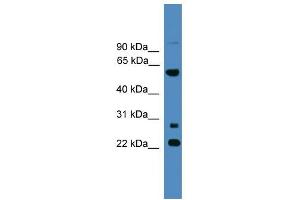 WB Suggested Anti-MNS1 Antibody Titration: 0.