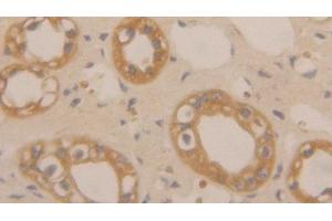 Detection of CLC in Human Kidney Tissue using Polyclonal Antibody to Charcot Leyden Crystal Protein (CLC) (Galectin 10 antibody  (AA 2-142))