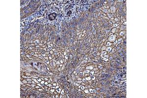 IHC analysis of CD147/Emmprin using anti-CD147/Emmprin antibody (ABIN7599999). (CD147 antibody  (AA 138-323))