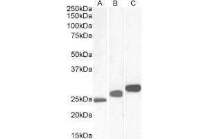 ABIN4902592 (0. (CSNK2B antibody)
