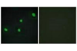 Immunofluorescence analysis of HepG2 cells, using CDCA4 antibody. (CDCA4 antibody)