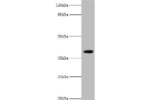 Western blot analysis of recombinant Carboxypeptidase G2 (0. (Carboxypeptidase G2 antibody  (AA 23-415))