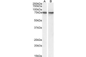ABIN571095 (1µg/ml) staining of HeLa (A) and (0. (Sorting Nexin 1 antibody  (Internal Region))