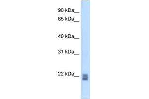 Western Blotting (WB) image for anti-Regulator of G-Protein Signaling 1 (RGS1) antibody (ABIN2462642) (RGS1 antibody)