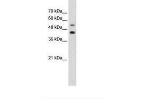 Image no. 1 for anti-GTP Binding Protein 2 (GTPBP2) (AA 511-560) antibody (ABIN203420) (GTPBP2 antibody  (AA 511-560))