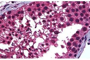 Human Testis: Formalin-Fixed, Paraffin-Embedded (FFPE) (Retinoic Acid Receptor alpha antibody  (AA 1-463))