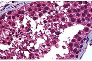 Human Testis: Formalin-Fixed, Paraffin-Embedded (FFPE) (Retinoic Acid Receptor alpha antibody  (AA 1-463))