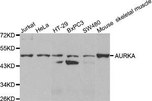 Western blot analysis of extracts of various cell lines, using AURKA antibody (ABIN5971148) at 1/1000 dilution. (Aurora A antibody)