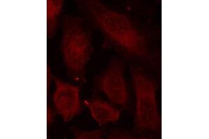Immunofluorescence staining of methanol-fixed Hela cells using Phospho-DOK2-Y299 antibody. (DOK2 antibody  (pTyr299))